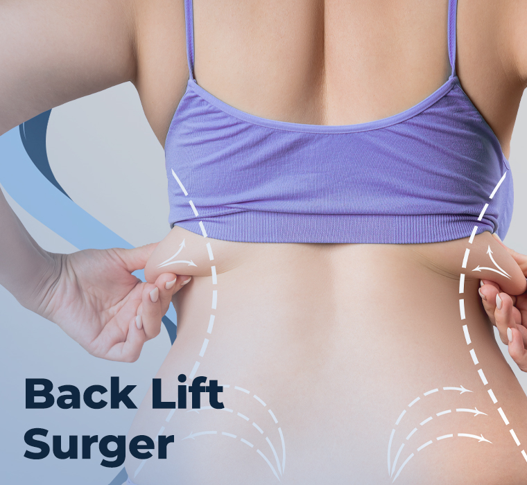 Back Lift Surgery